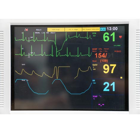 how to use suzy hood ecg machine southmed dunedin new zealand